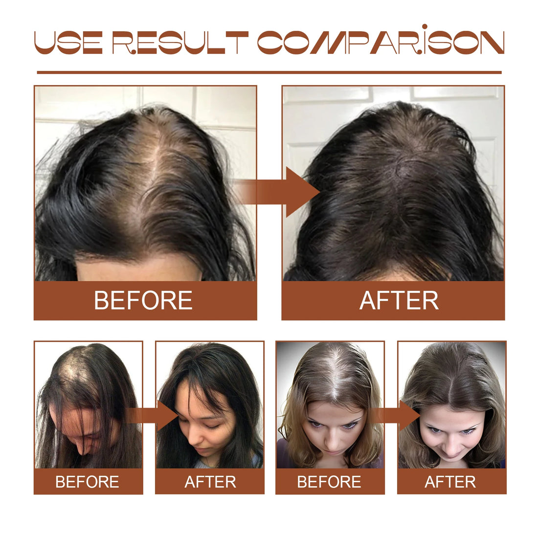 Oil Hair Conditioner Serum for Smooth & Shiny Hair