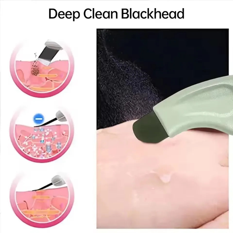 Blackhead and Whitehead Removal Tool for Nose & Face Care